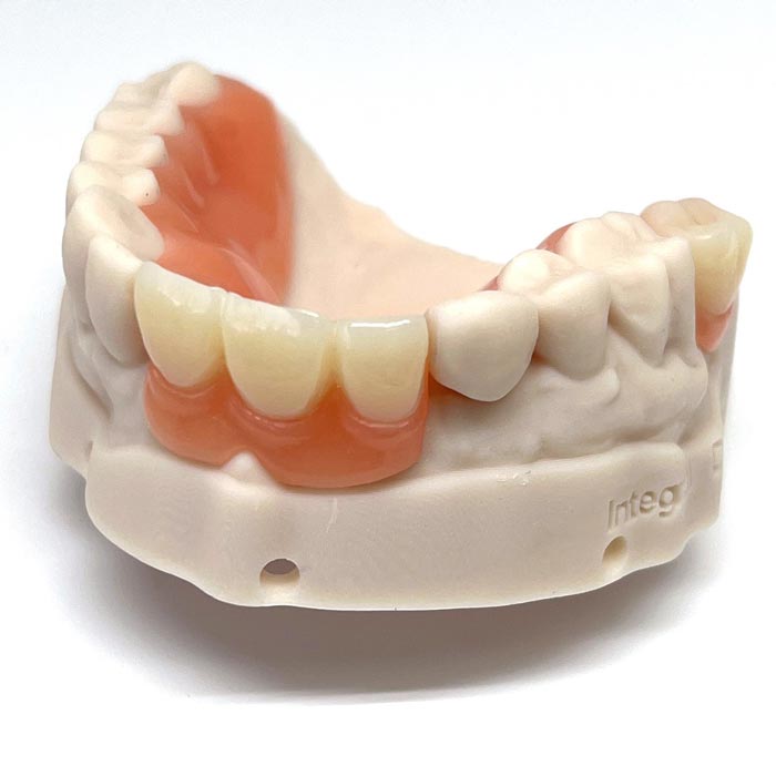 Acrylic/Flexible Partial Dentures Services in Vancouver, BC